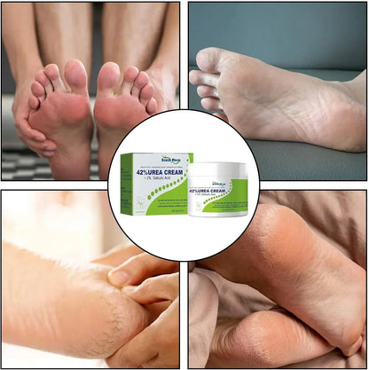 South Moon - 42% Urea Cream + 2% Salicylic Acid (Original)
